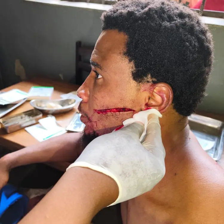 Prison de Kondengui : un détenu politique poignardé par l'assassin d'Avenur Ava