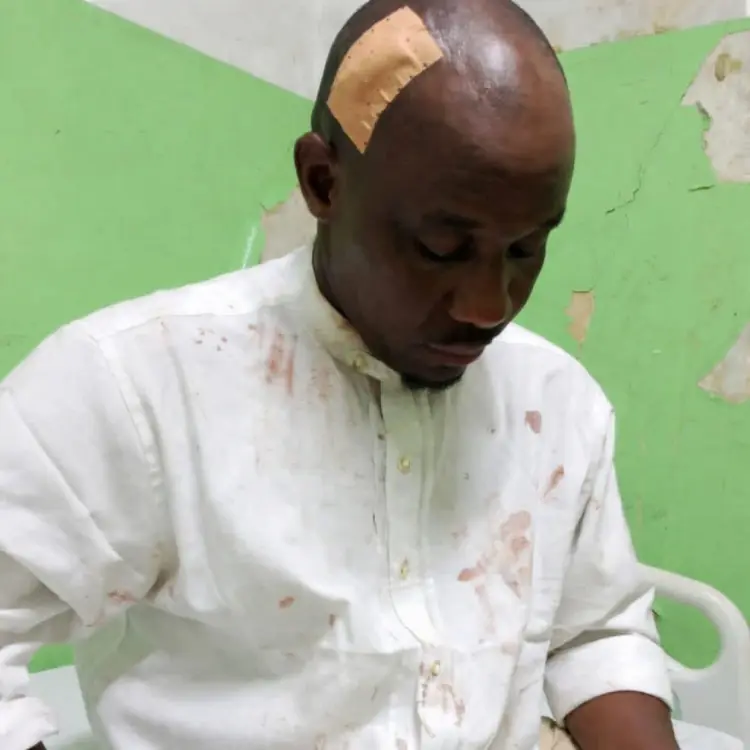 Un Activiste Torturé et Interné de Force à Douala . L'État Hors la Loi