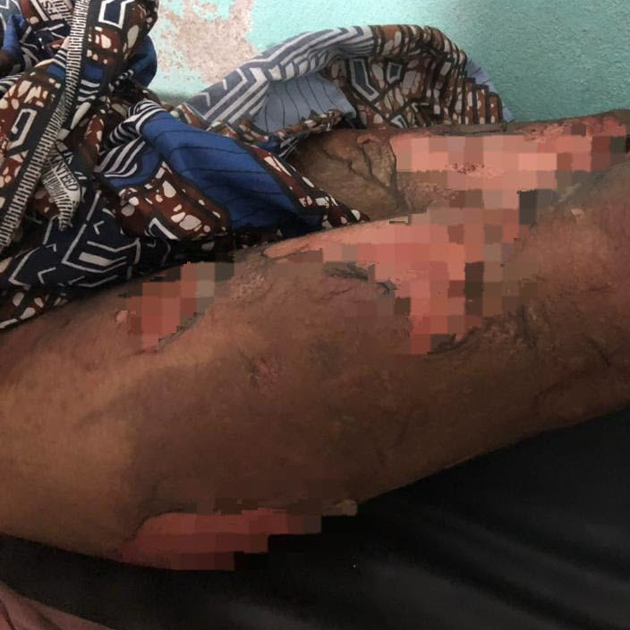 Violence conjugale : un drame qui interpelle la société camerounaise et ses institutions :: CAMEROON Violence conjugale : un drame qui interpelle la société camerounaise et ses institutions
